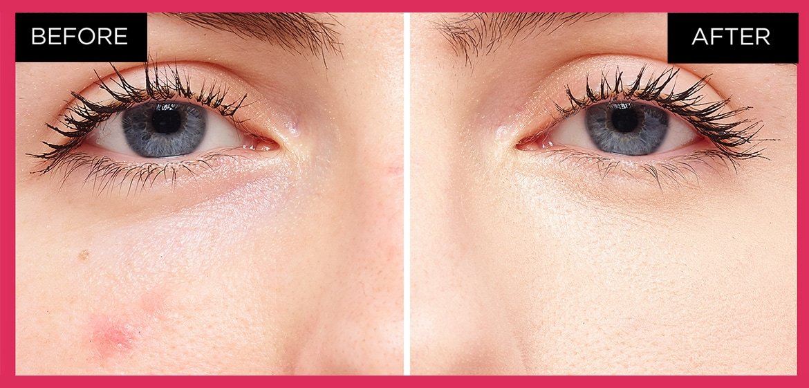 Concealer Vorher Nachher
